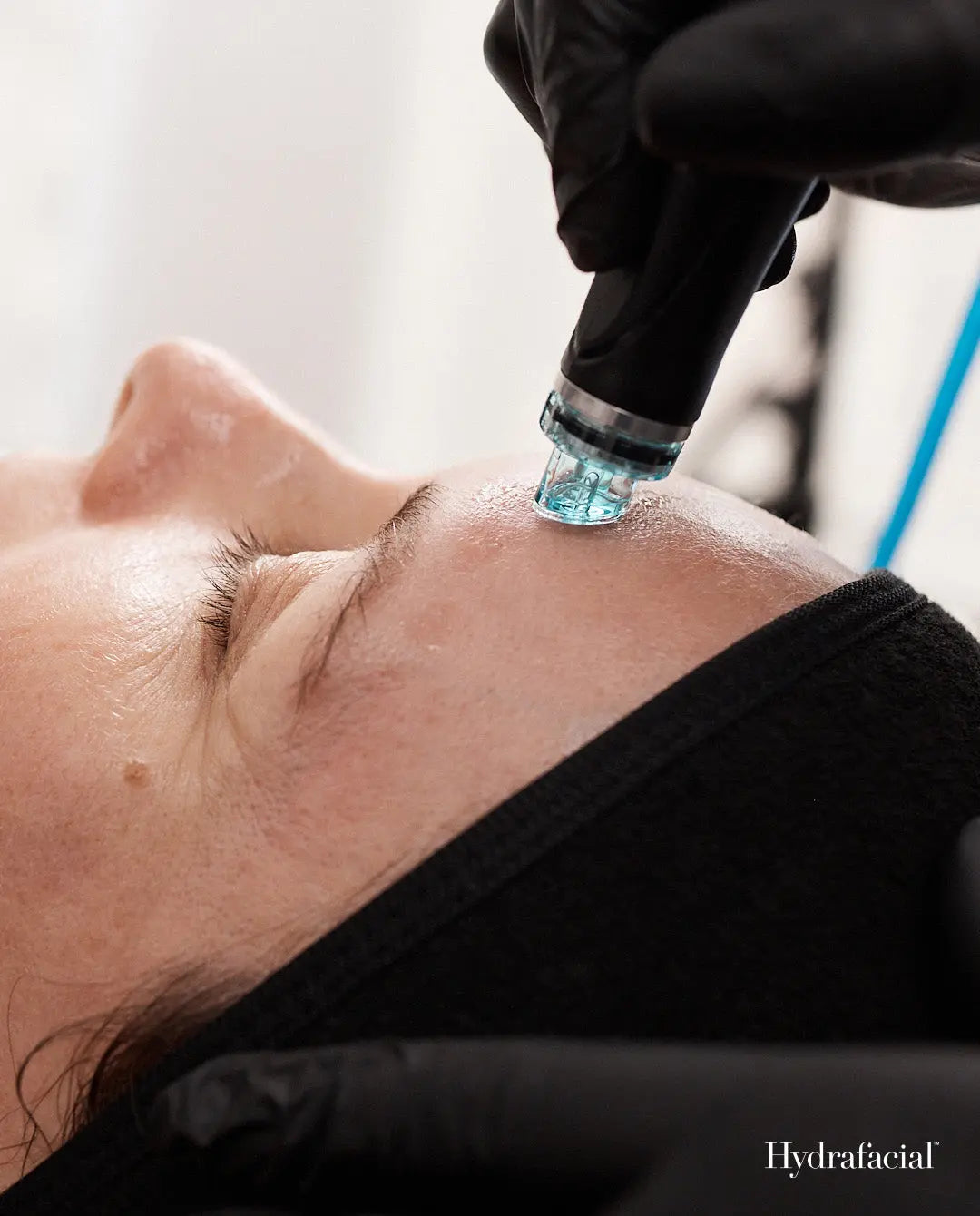 HydraFacial - Gilbert, AZ